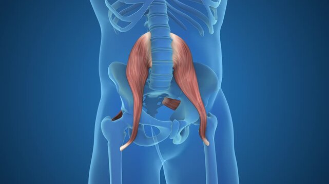 Psoas And Piriformis Causing Sciatica Pain