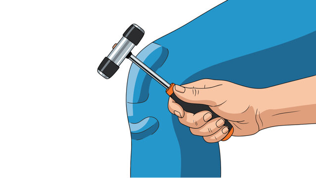Doctor's hand holding a reflex hammer performing a neurological examination on a patient's knee to test reflexes in a medical clinic setting.