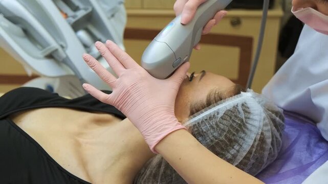 High precision ultrasound applicator targeting SMAS lifting superficial muscular aponeurotic system zones along jawline and chin. Non surgical face lifting and contour sculpting in aesthetic medicine