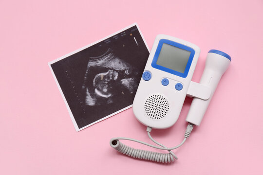 Fetal doppler with sonogram image on pink background