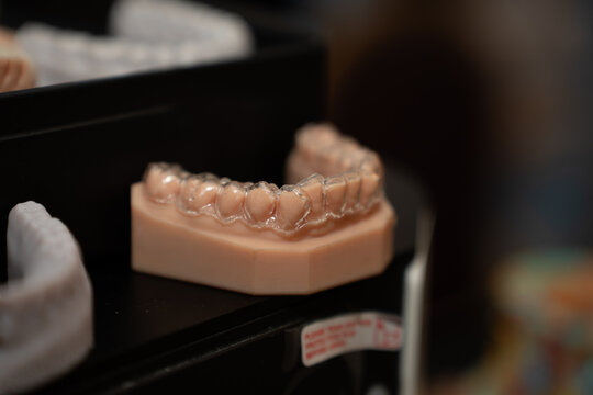 3D printed dental model and dental plaque.