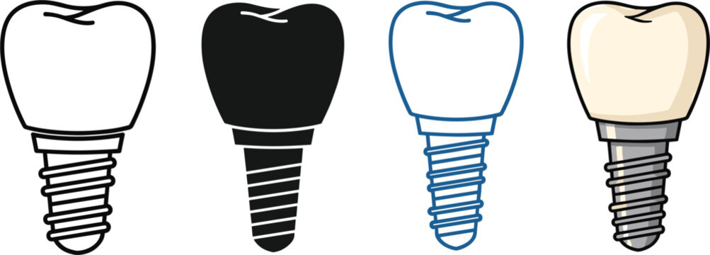 Dental Implant Icon Set with Different Colors for Tooth Replacement and Oral Health in Digital Media.