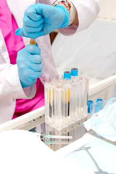 Blood plasma in tubes. Regenerative medicine. Lab technician holding test tube of blood sample after being centrifuged. Chemistry laboratory. Non-surgical procedures. Blood taken from patient