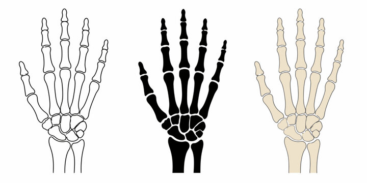 An illustration shows three human hand skeletons in different colors.