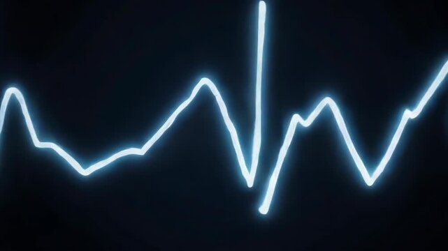 Dynamic Blue ECG Waveform Animation on Dark Background. Pulsing Heartbeat and Vital Signs Data Displayed on Medical Monitor.