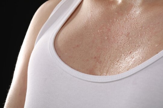 Young guy with sweat on his body against black background, closeup