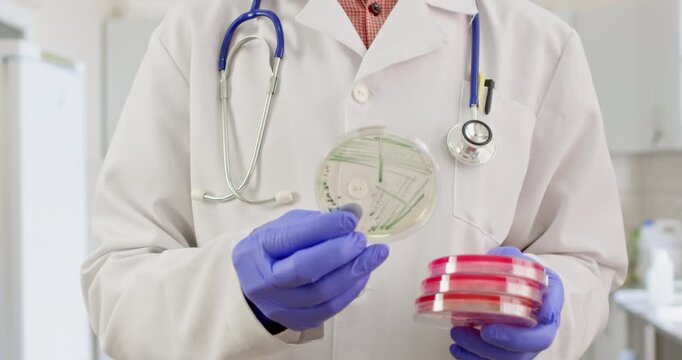 A doctor in a white coat holds Petri dishes with various bacteria in his hands and analyzes the results of bacteriological studies.