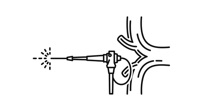 Endoscope Inserting into Artery for Medical Procedure