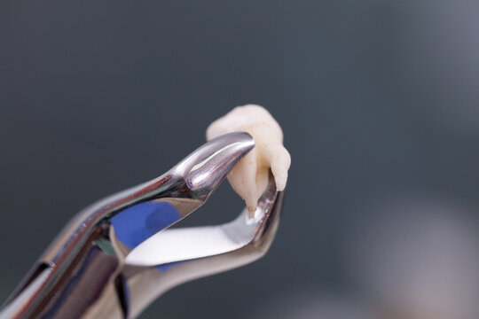 Close up of the tooth root