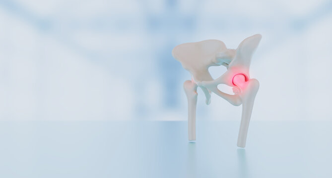 Degeneration of the hip joint with signs of pain and bone inflammation in the femoral head and acetabulum over bokeh. 3D render
