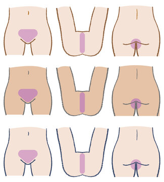 VIO hair removal area illustration set: V-line, I-line, and O-line