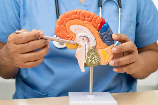 Alzheimer disease, Asian doctor holding brain anatomy model for study diagnosis and treatment in hospital.