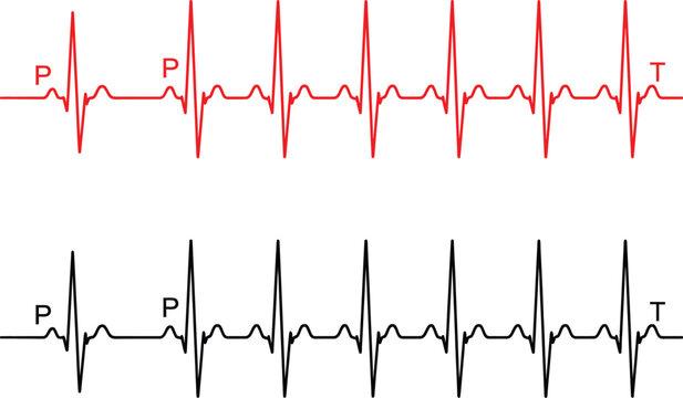 Heartbeat ecg rhythm Vector