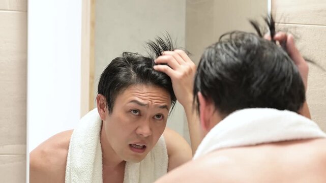 髪の生え際を気にする日本人男性