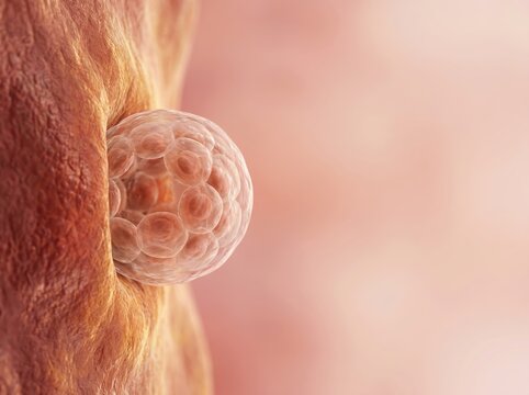Medical 3D illustration of human blastocyst embryo implantation into the uterus wall.