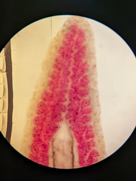 Planaria Flatworm Whole Mount With Injected Gastrovascular Canal System Revea