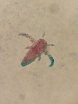 Artemia Nauplius Larva Whole Mount Showing Early Crustacean Larval Developme