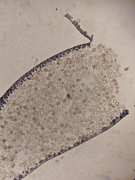 Ascaris megalocephala Egg Pronuclei Stage Showing Early Fertilization Divis