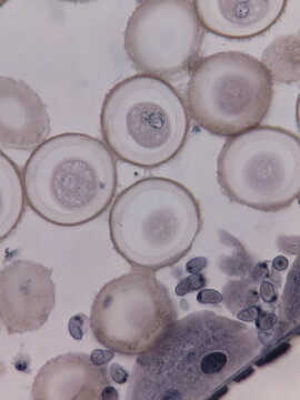 Ascaris megalocephala Egg Pronuclei Stage Showing Early Fertilization Divis