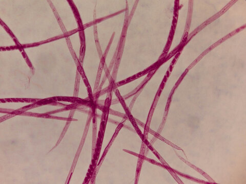 Vinegar Eel Nematode Whole Mount Showing Elongated Transparent Body Str