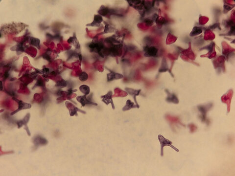 Arbacia Pluteus Larva Showing Skeletal Rods and Triradiate Spicules Under Micros`