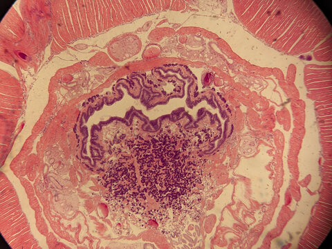Earthworm Pharynx Cross Section Showing Muscular Wall and Glandular Tis