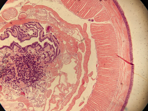 Earthworm Pharynx Cross Section Showing Muscular Wall and Glandular Tis