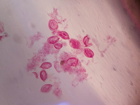 Euplotes Ciliate Whole Mount Silver Stained Showing Cirri and Macronuc