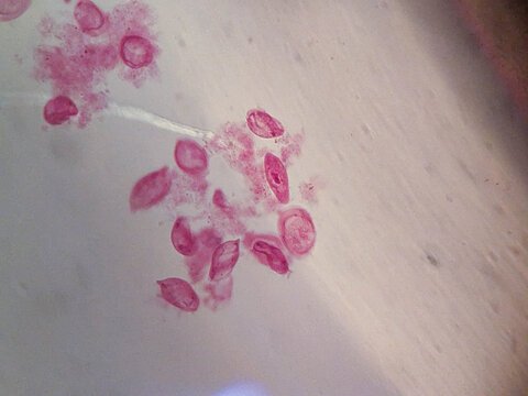 Euplotes Ciliate Whole Mount Silver Stained Showing Cirri and Macronuc