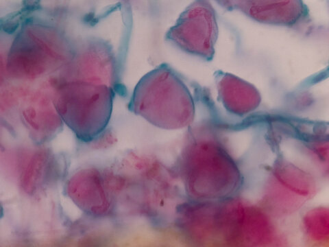 Zoothamniom Colonial Peritrich Ciliate Showing Branched Stalk and Bell Shaped Z