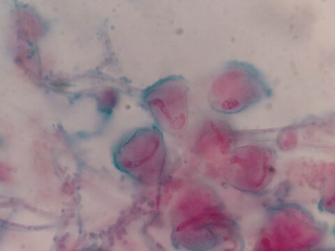 Zoothamniom Colonial Peritrich Ciliate Showing Branched Stalk and Bell Shaped Z
