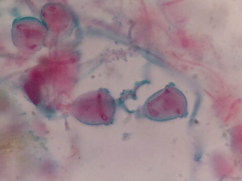 Zoothamniom Colonial Peritrich Ciliate Showing Branched Stalk and Bell Shaped Z
