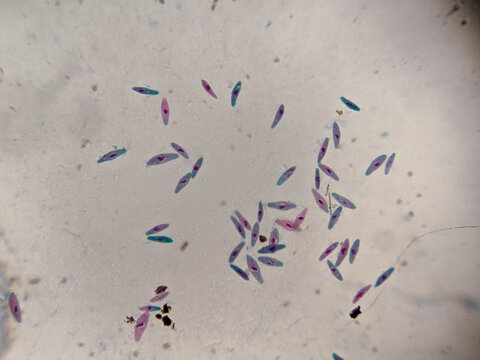 Pamecium multimicronucleatum Stained Preparation Showing Multiple Micronuclei and Macronucleus