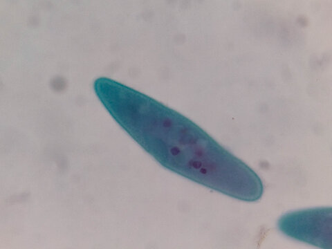 Pamecium multimicronucleatum Stained Preparation Showing Multiple Micronuclei and Macronucleus