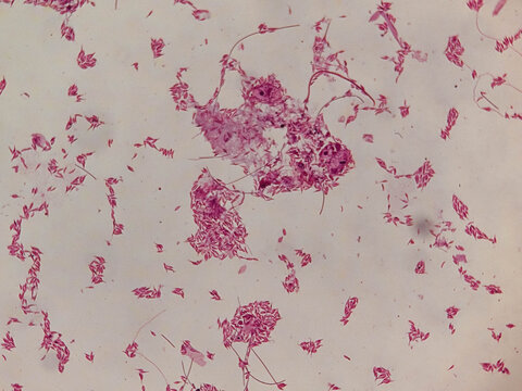 Astasia klebsii Euglenoid Whole Mount Showing Elongated Colorless Cells and Flag