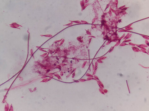 Astasia klebsii Euglenoid Whole Mount Showing Elongated Colorless Cells and Flag