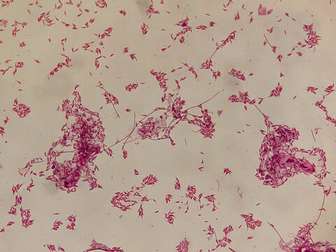 Astasia klebsii Euglenoid Whole Mount Showing Elongated Colorless Cells and Flag