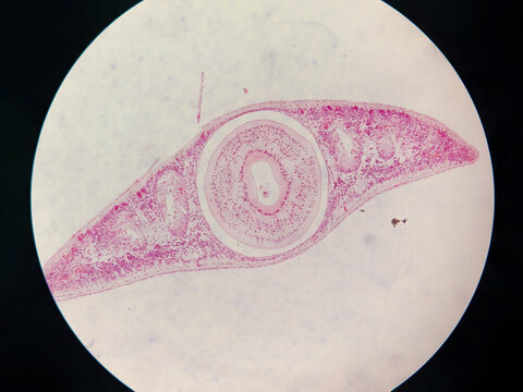 Planaria Flatworm Longitudinal Section Showing Internal Organ Structu