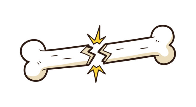 A cartoon illustration depicts a fractured bone with jagged breaks and small bright yellow starbursts