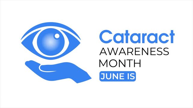 Clean flat vector animation highlighting cataract awareness with eye care concept, suitable for medical campaigns and vision health promotion.  4k video animation.