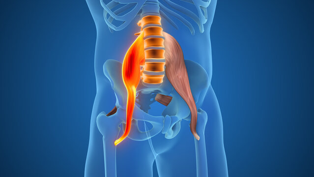 Psoas And Piriformis Causing Low Back Pain