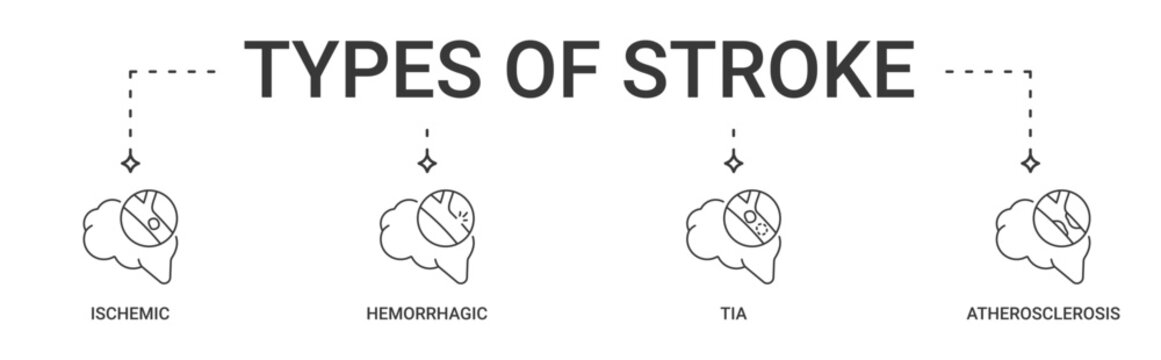 Types of Stroke banner containing ischemic, hemorrhagic, TIA and atherosclerosis vector icons