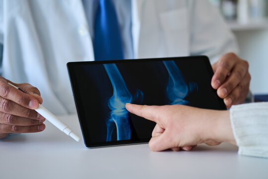 A doctor and tablet for x ray with knee, scan or osteoporosis with point at hospital. People, application and ux for medical consultation for arthritis, feedback or report for wellness at clinic