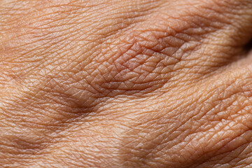 Fototapeta premium Extreme Macro Texture of Human Skin Surface,High-detail macro shot showing the complex texture, High-detail macro shot showing the complex texture, pores, and natural patterns of human skin, highlight