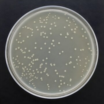 petri dish with Escherichia coli colonies on agar, small circular white colonies