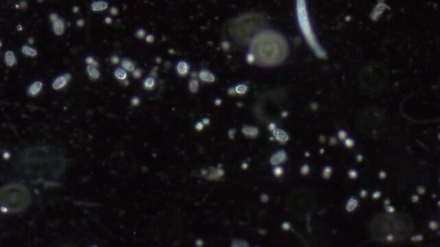 Movement of single-celled protozoa in water under a microscope on a dark background.