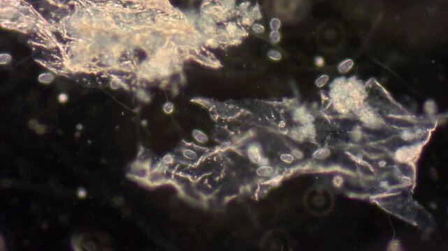 Small ciliates move in liquid when magnified under a microscope.