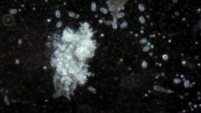 Young ciliate cells move in the liquid with the help of small cilia; the microscope enlarged the ciliates.