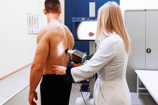 Digital dermatoscopy. Early diagnosis and prevention of skin cancer. Doctor and patient.