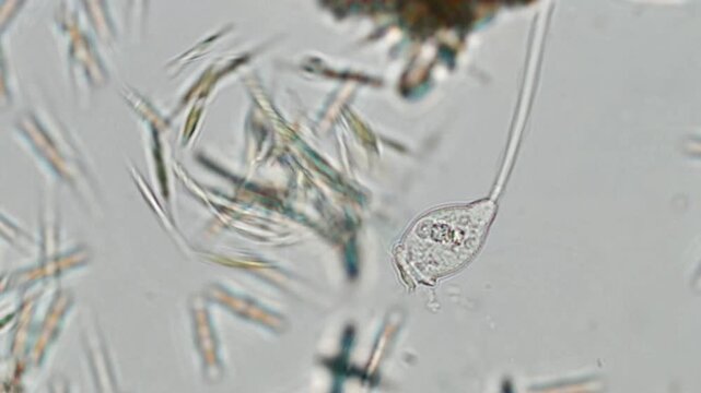 Vorticella sp. under brightfield microscopy at 20x